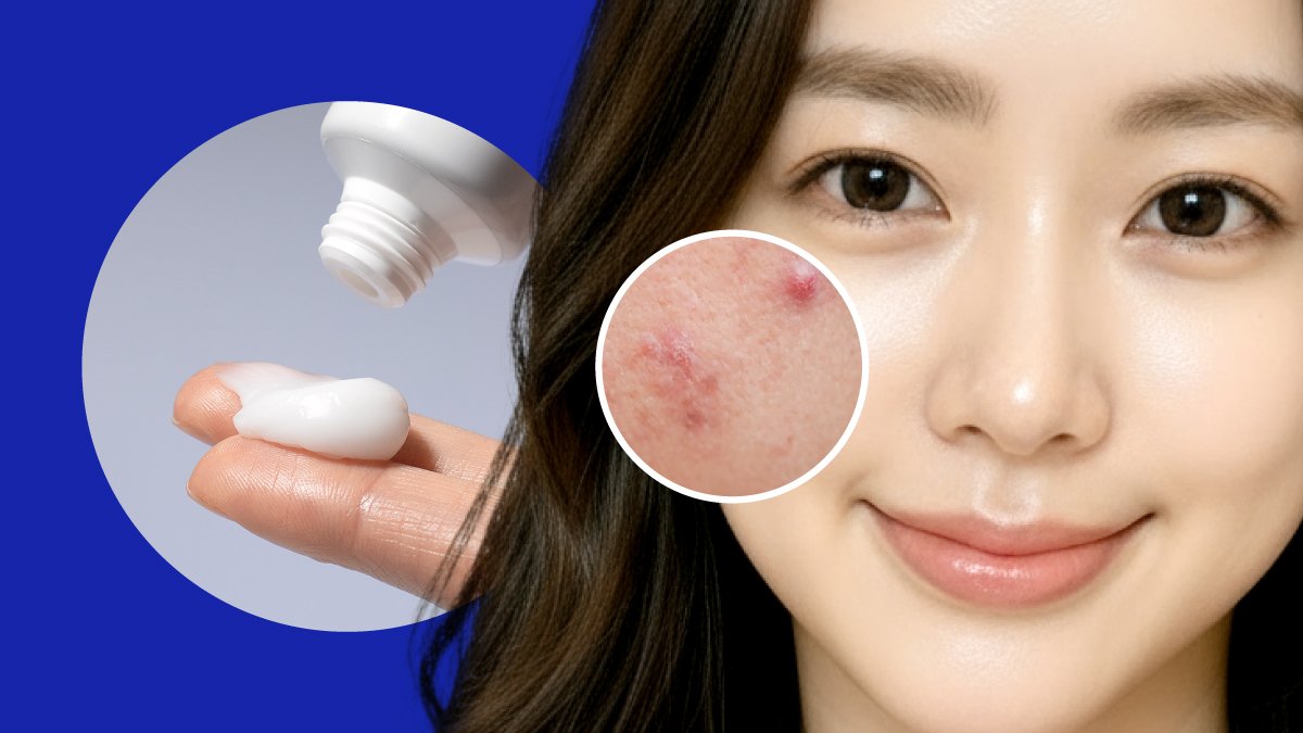 트러블 홍조 끝! 유황MSM의 회복 메커니즘. 피부 자생광채ㅣ5%유황크림