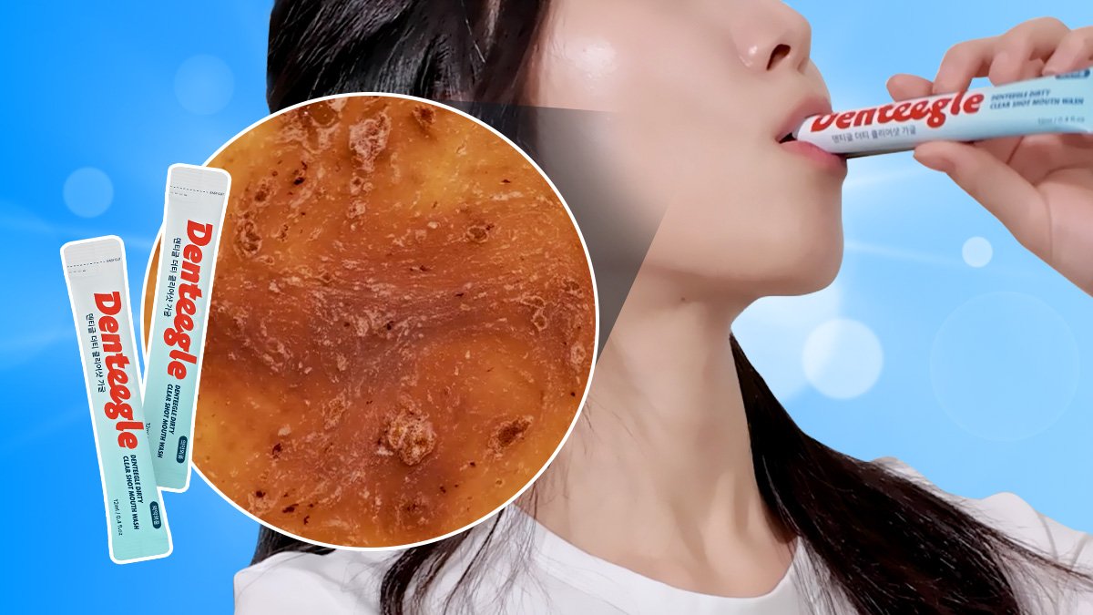 내 입 안에 이런 게 있었다고?🦠｜뱉는 순간 깜짝놀라는 찌꺼기 흡착가글