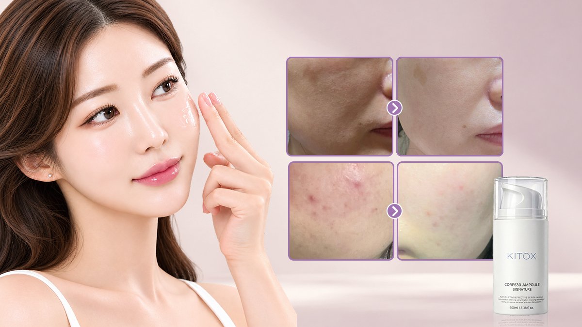 [5.0만점/3차앵콜] 피부장벽부터 수분·보습까지! 천재앰플 코어530✨