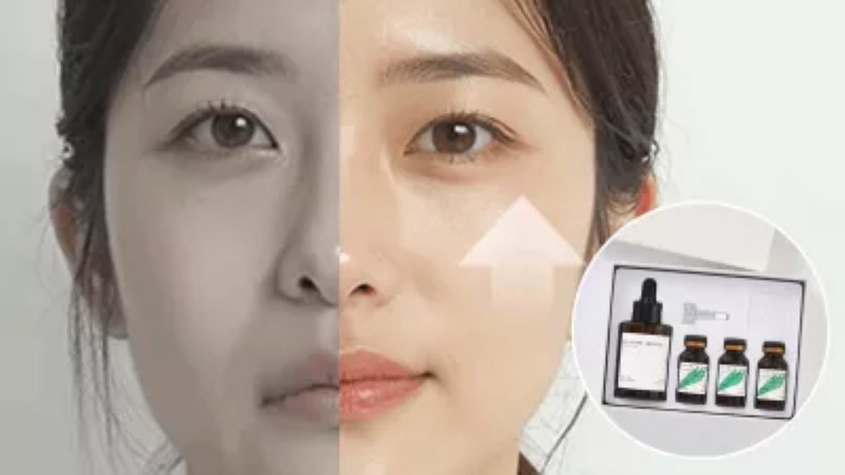 [1억앵콜] 시술없이 무너진 중안부 매주 157%씩 끌어올리는 반중력앰플
