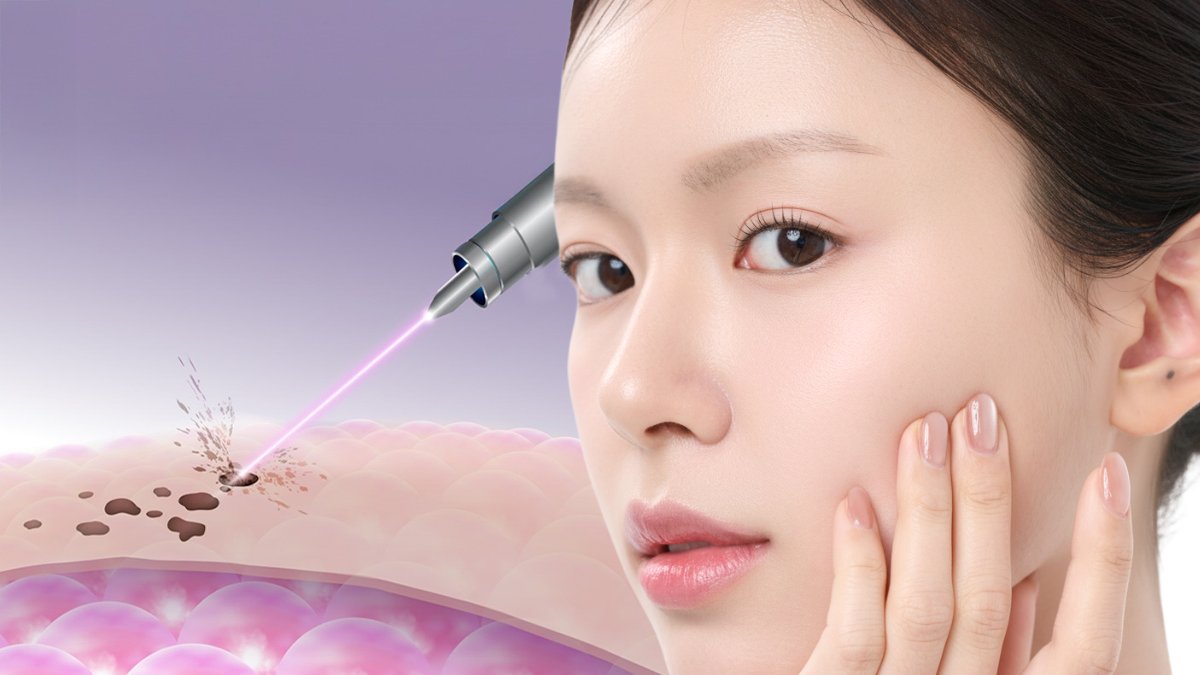 🚨마감임박🚨 트러블, 흔적까지 남겨 고민? 점 빼고 싹 지워드릴게요!